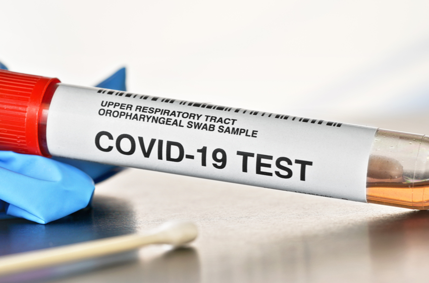 Тесты на коронавирус виды и особенности